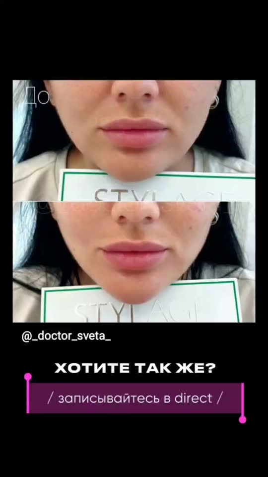 STYLAGE — результат до и после