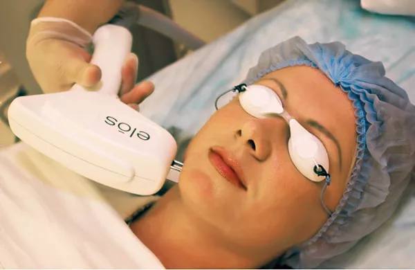 ЭЛОС - омоложение лица — Аппаратная косметология в Казани