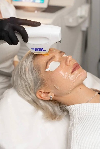 HIFU IPL (фотоомоложение + лифтинг) - Лицо + шея — Аппаратная косметология в Казани